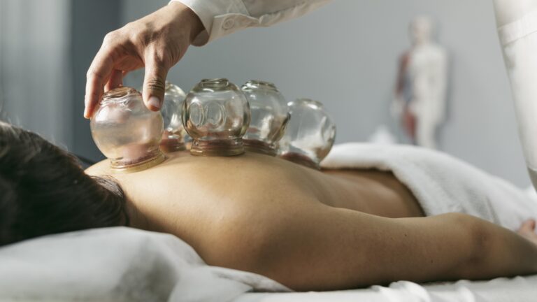 client lying down receiving a hijama treatment with multiple glass cupping jars